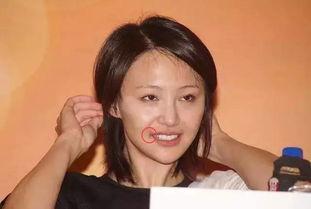 嘴角长痣女明星,揭秘那些痣痣生辉的女明星风采”